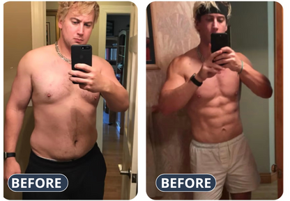 Lymphatic Support Drops